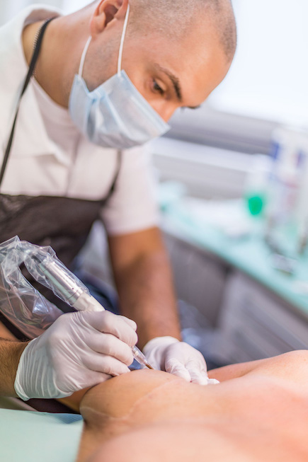 Penoidaufbau ergebnis